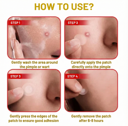 Flex Microneedle Mole Removal Patch – Removes in 5 Days Without Scarring